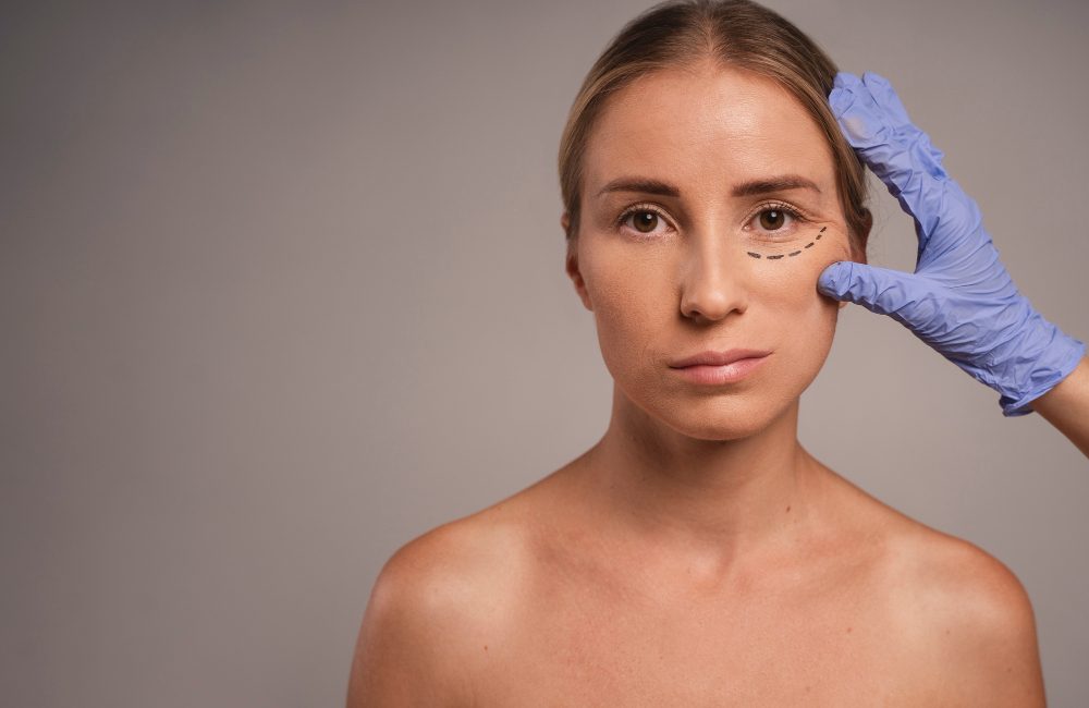 Cirugía de blefaroplastia