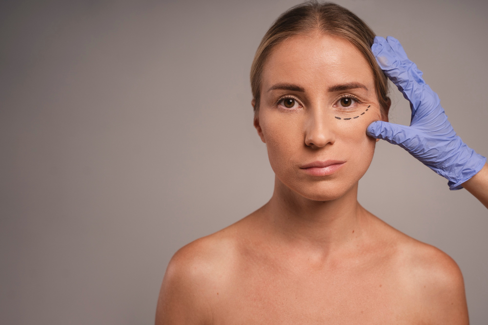 Cirugía de blefaroplastia