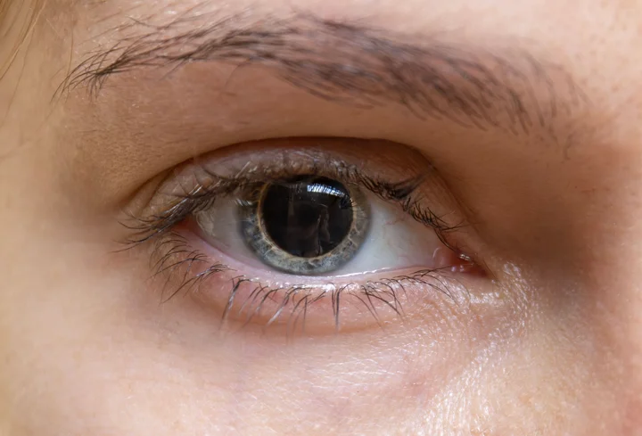 Paciente con Pupilas dilatadas o midriasis