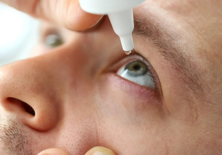 Cómo poner colirio o pomada en el ojo