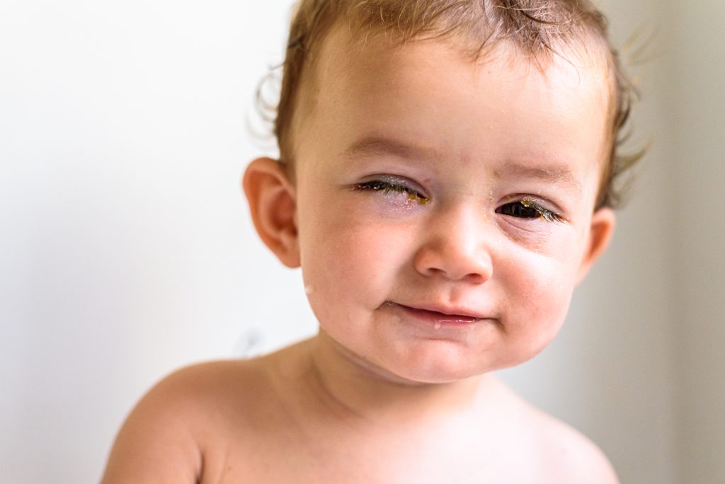 Diferencia entre conjuntivitis y mocos en los ojos de los niños