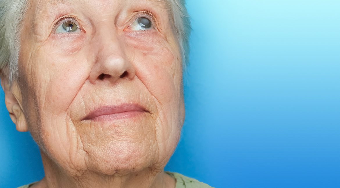 Tratamientos para curar el glaucoma