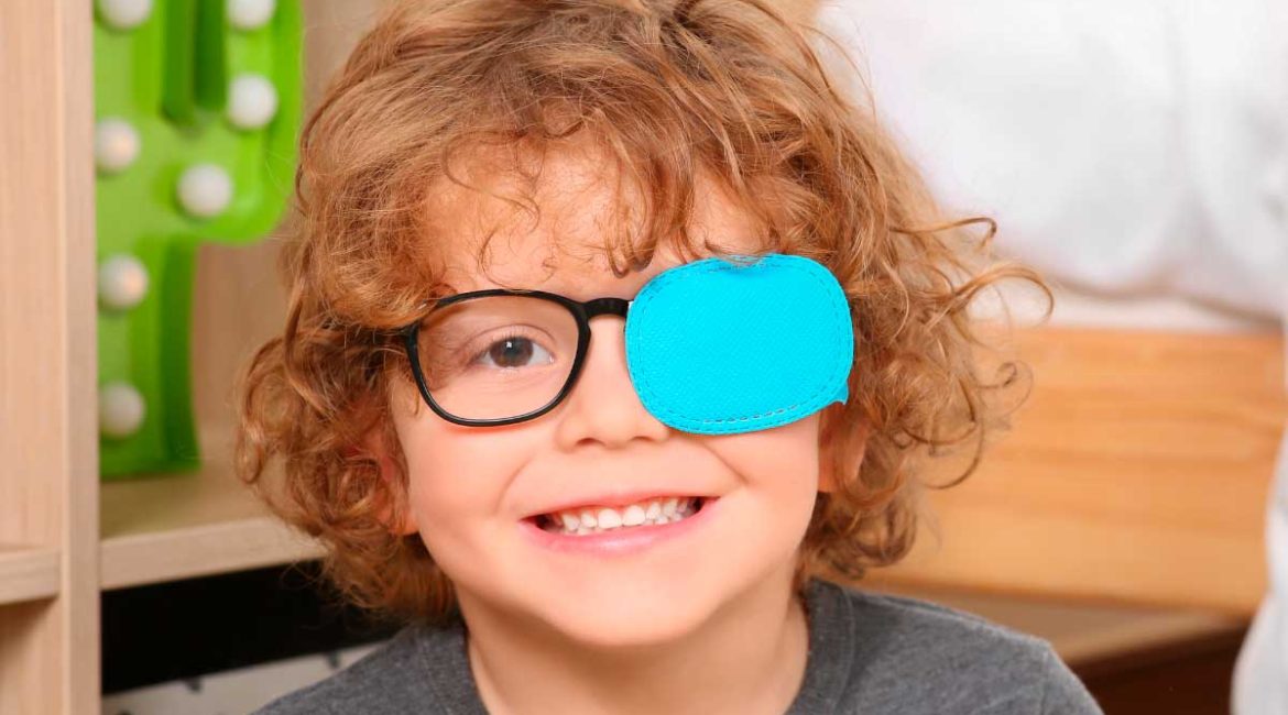 Ojo vago en niños: Todo lo que tienes que saber
