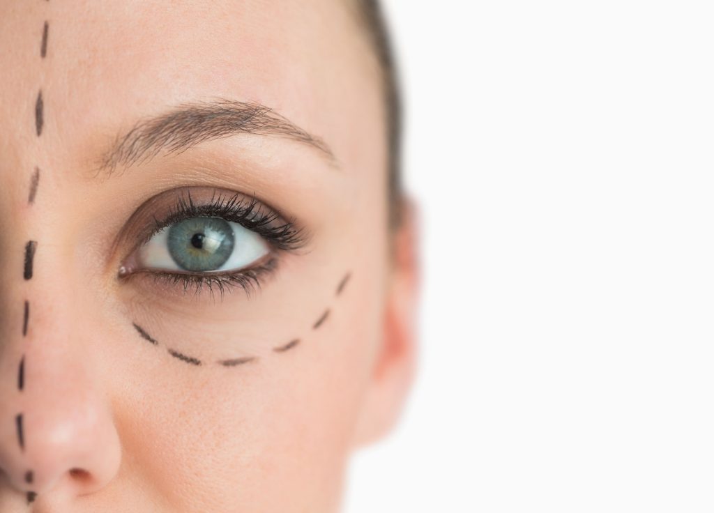 Oculoplastia – Qué es y para qué sirve