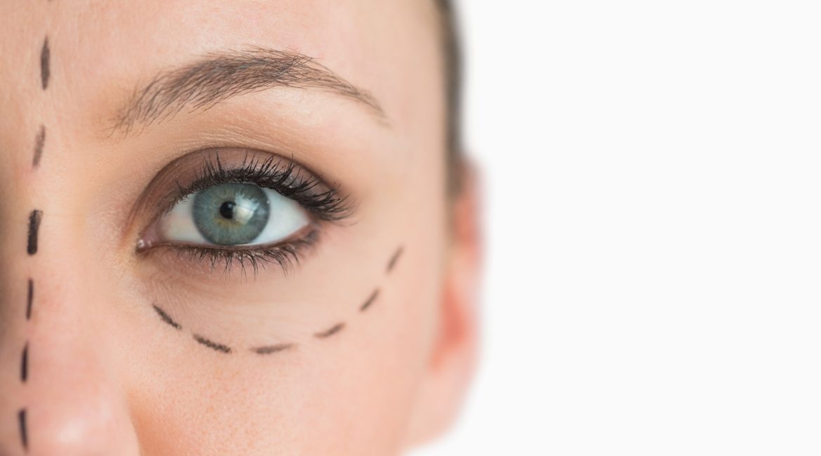 Oculoplastia – Qué es y para qué sirve