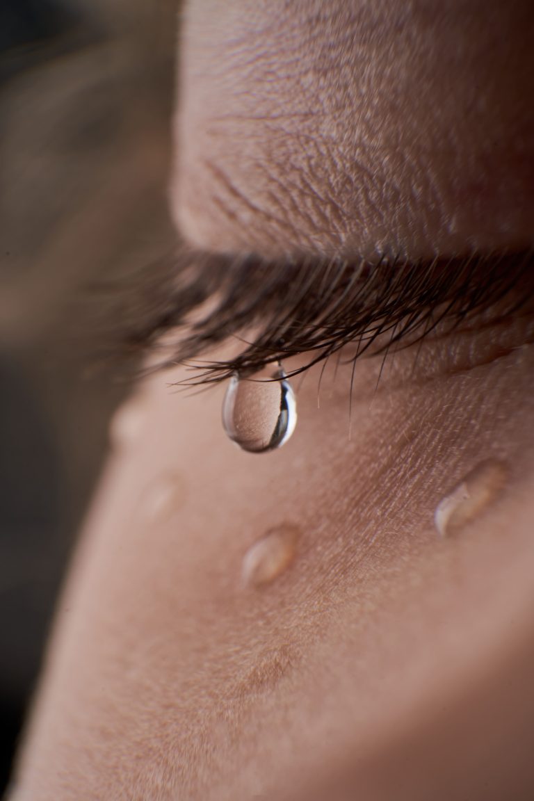¿Por qué me lloran los ojos? Exceso de flujo lagrimal
